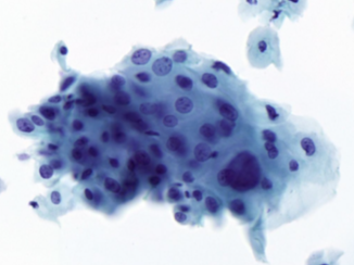 Digital Pathology