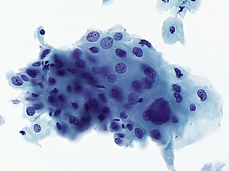 Digital Pathology
