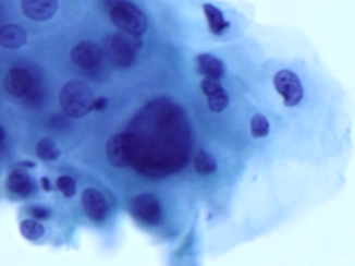 Digital Pathology