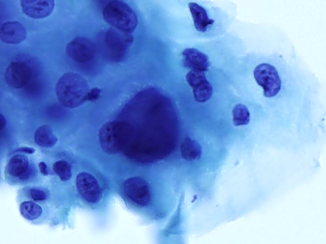 Digital Pathology