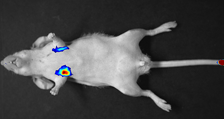 VISQUE InVivo Smart-LF