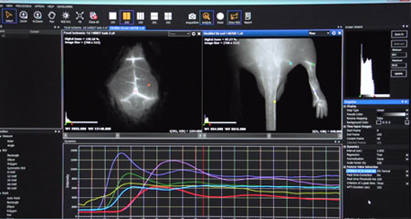 VISQUE InVivo Smart-LF