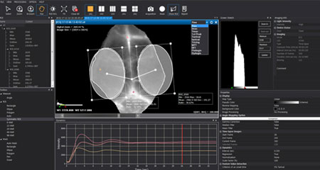 VISQUE InVivo Smart-LF