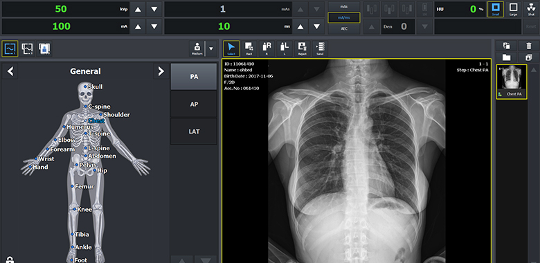 Radiography Acquisition Software - VXvue