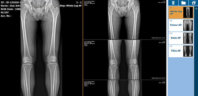 Radiography Acquisition Software - VXvue