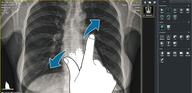 Radiography Acquisition Software - VXvue