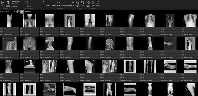 Mini PACS – QXLink