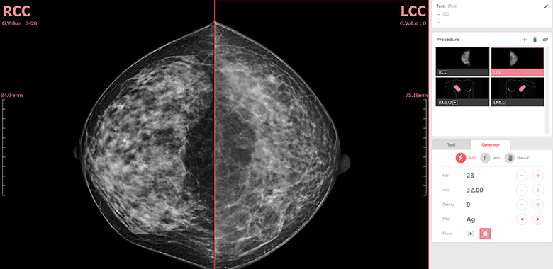 Mammography Acquisition Software - VXvue Mammo